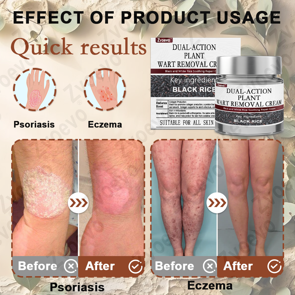 Zvoevo® Black Rice Essence Cream⚕️FDA Certified (Removes warts and skin growths, improves seborrheic keratosis, skin cancer, and hidradenitis suppurativa, treats purpura and eczema)