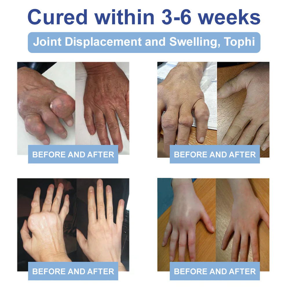 ✅FDA Certified :  Rekulo® Black Rice Pain Healing Bone Cream ( Treatment for arthritis, neuropathyy, rheumatic diseases, sports injuries, muscle spasms and twitches)