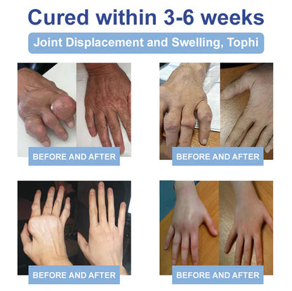 ✅ FDA Certified: Rekulo® Magnesium Pain Healing Bone Cream (for the treatment of arthritis, neuropathy, rheumatism, sports injuries, muscle stiffness and spasms)