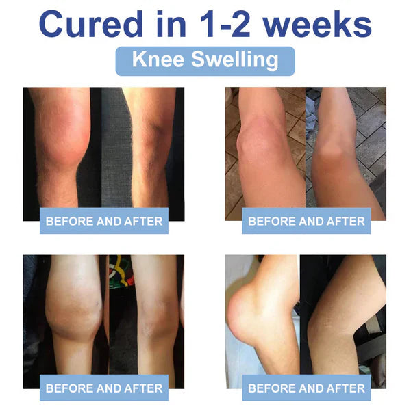 ✅ FDA Certified: Rekulo® Magnesium Pain Healing Bone Cream (for the treatment of arthritis, neuropathy, rheumatism, sports injuries, muscle stiffness and spasms)